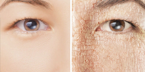 Can Humidifiers Help With Dry Skin?--KELOPA