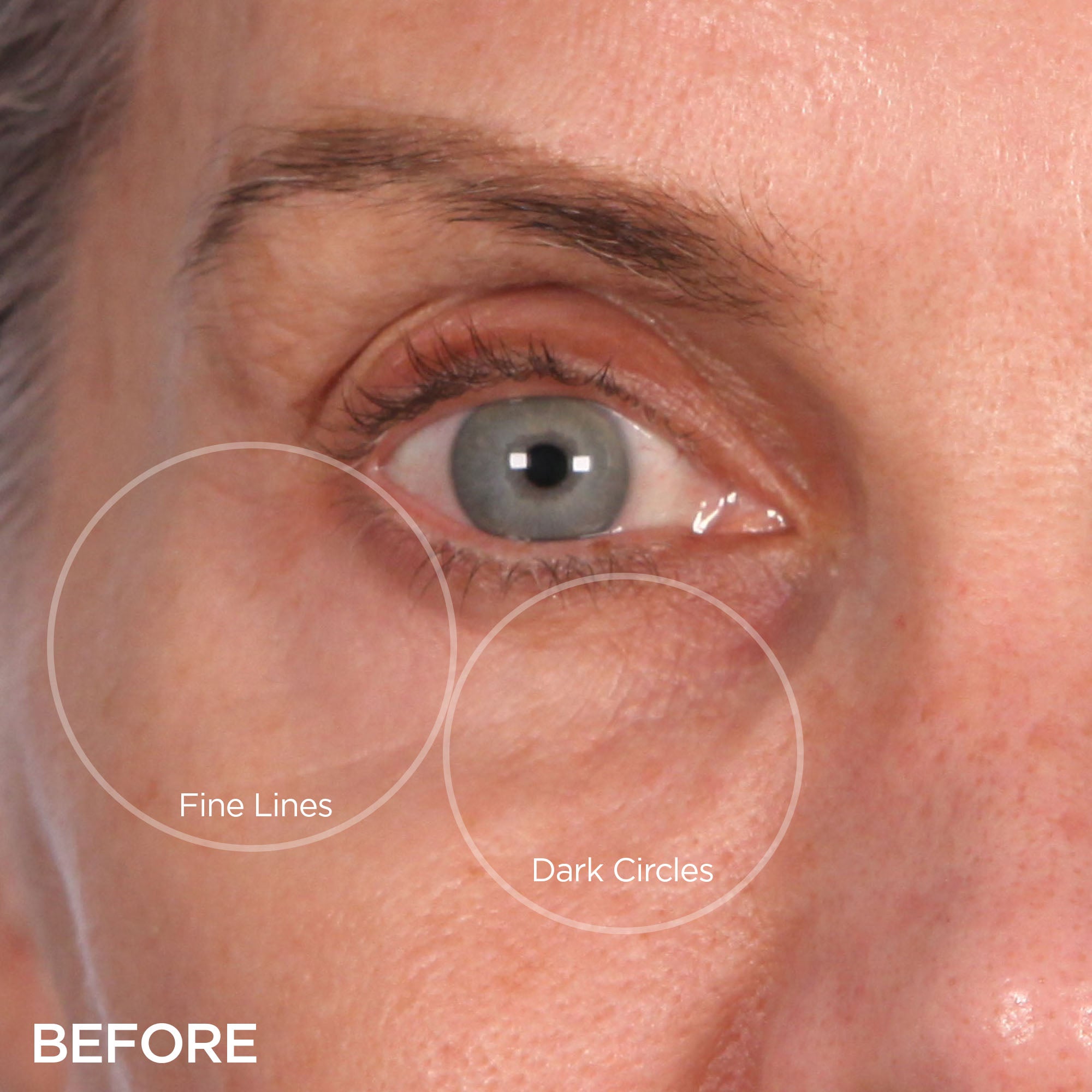 eyelids,eyelash solutions for sagging eyelids, dark circles, puffiness, & more