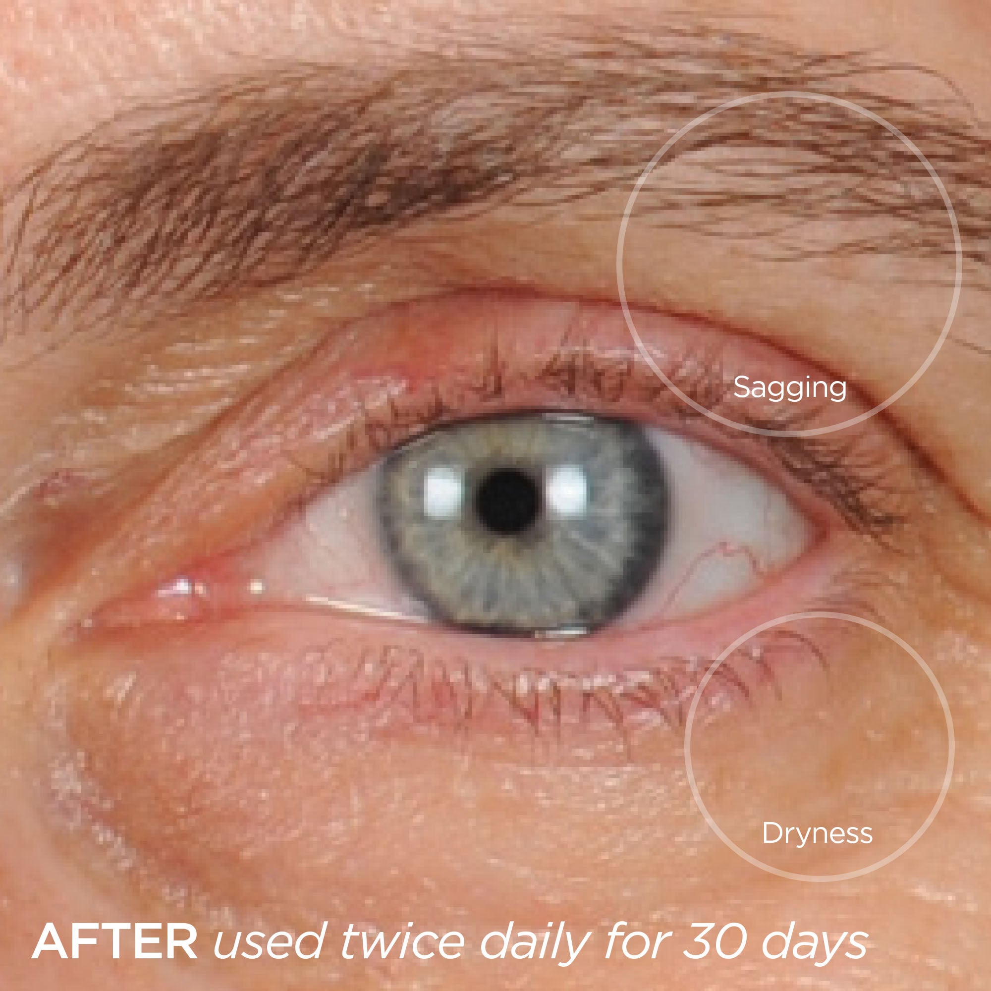 eyelids,eyelash solutions for sagging eyelids, dark circles, puffiness, & more