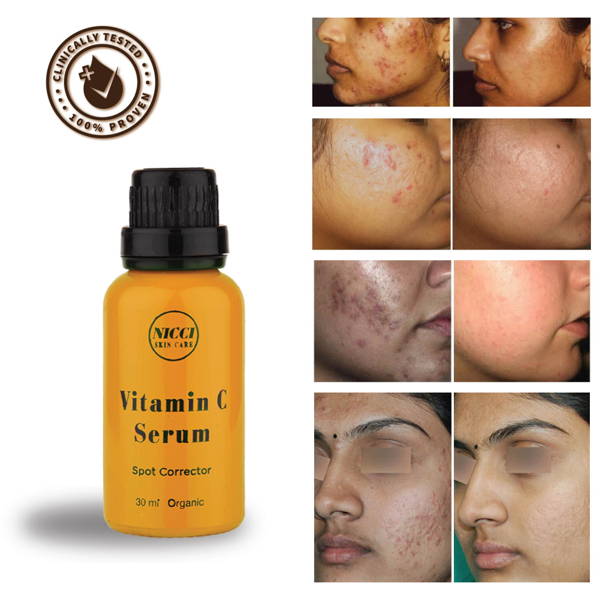 Spot Corrector Vitamin C Serum Best Skin Serum For Hyperpigmentation Nicci Skin Care