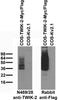 针对用Myc / Flag标签的TWIK-2瞬时转染的COS细胞提取物或用N469 / 28（左）或兔抗Flag（右）探测的未标签Kv2.1质粒瞬时转染的免疫印迹。