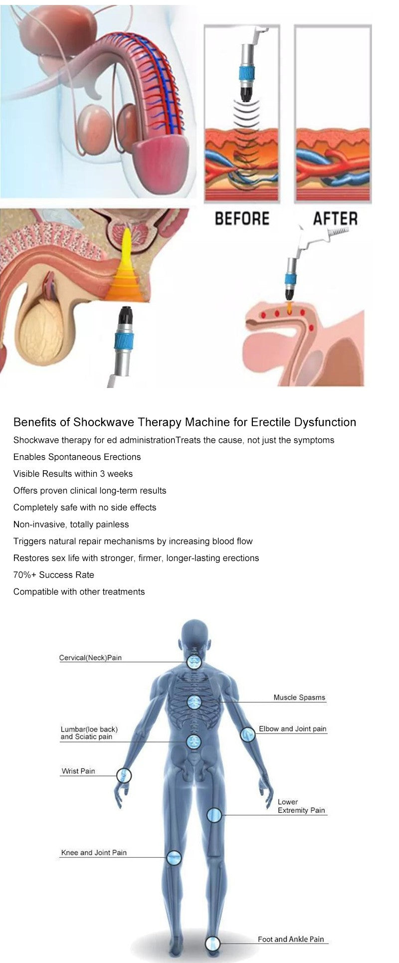 ED Shockwave Therapy Machine Back Pain Relief Pneumatic ED Treatment Shock  Wave