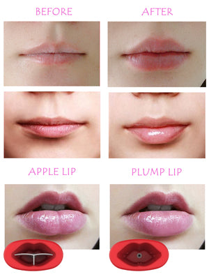 automatic lip plumper