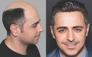 men's hair systems before and after