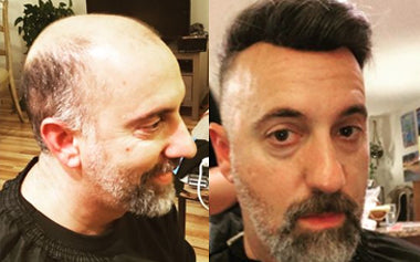 men's hair systems before and after