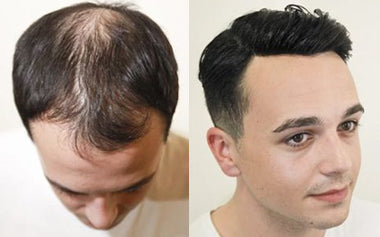 men's hair systems before and after