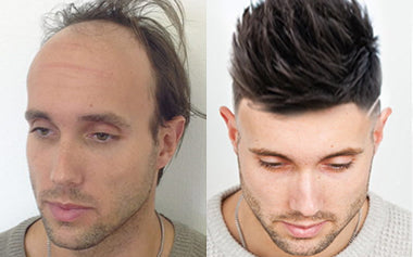 men's hair systems before and after