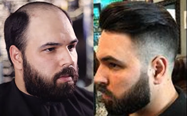 men's hair systems before and after