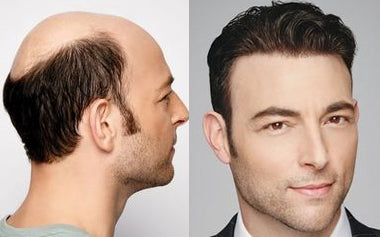 men's hair systems before and after