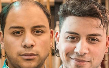 men's hair systems before and after