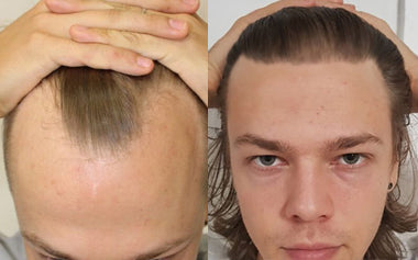 men's hair systems before and after