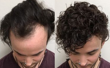 men's hair systems before and after