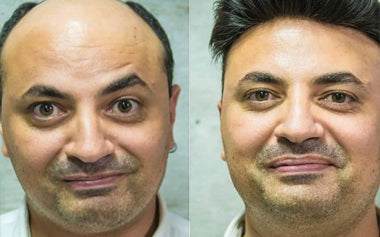 men's hair systems before and after