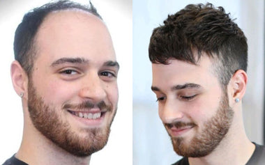 men's hair systems before and after