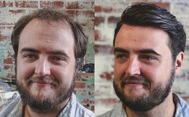 men's hair systems before and after