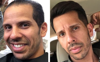 men's hair systems before and after