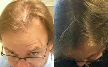 men's hair systems before and after