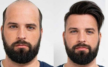 men's hair systems before and after