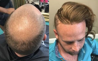 men's hair systems before and after