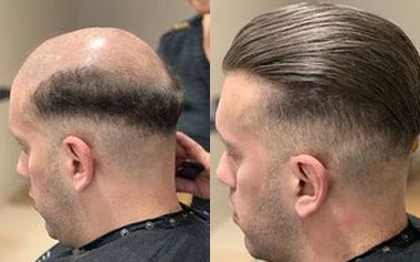 men's hair systems before and after