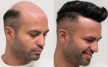 men's hair system photos