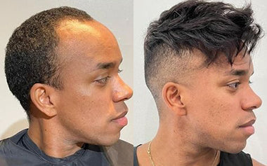 men's hair systems before and after