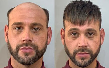 men's hair systems before and after