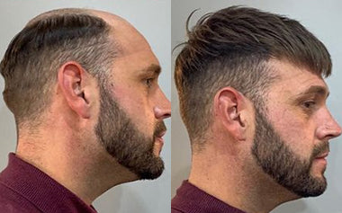 men's hair systems before and after