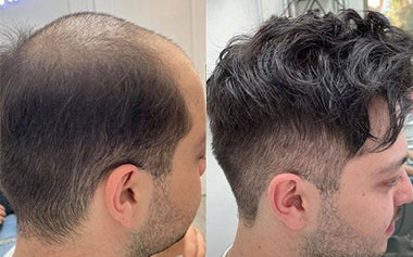 men's hair systems before and after