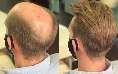 men's hair systems before and after