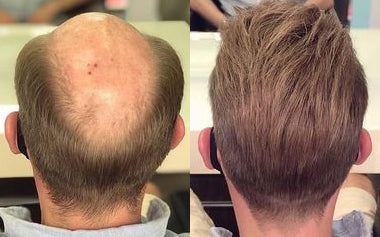 men's hair systems before and after