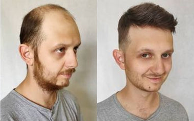 men's hair systems before and after