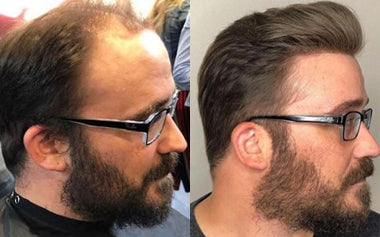 men's hair systems before and after