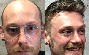 men's hair systems before and after