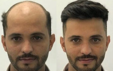men's hair systems before and after