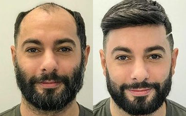 men's hair systems before and after