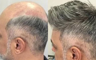 men's hair systems before and after