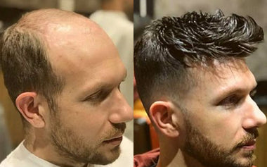 men's hair systems before and after