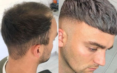 men's hair systems before and after