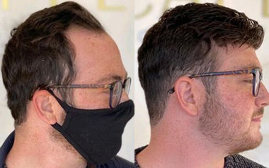 men's hair systems before and after