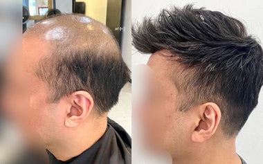 men's hair systems before and after