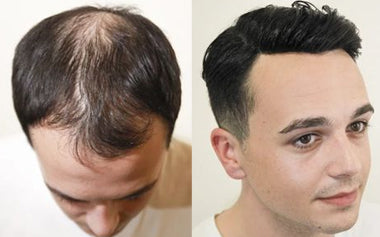 men's hair systems before and after