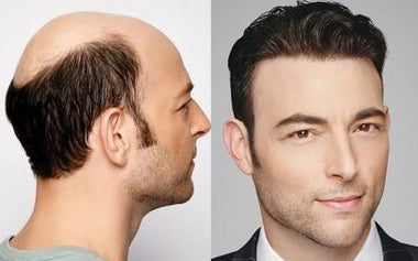 men's hair systems before and after