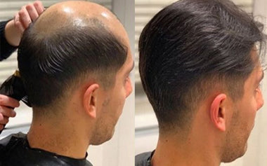 men's hair systems before and after