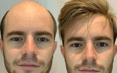 men's hair systems before and after