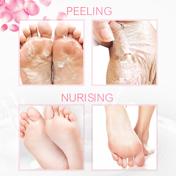 4 Pairs Rose Foot Peeling Mask, 7 Days Repair Rough Heel for Soft Nourish Feet, Removes Calluses & Dry Skin