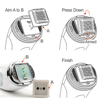 Treatment Tip Installation.