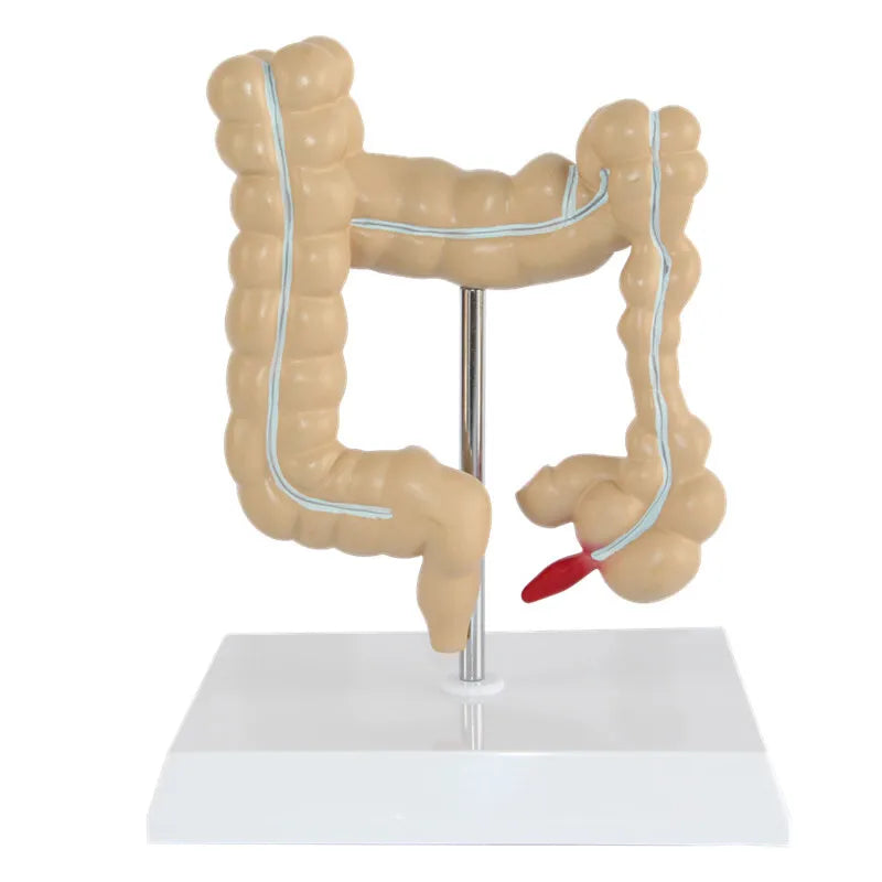 Anatomical Human Colorectal Lesion Model Anatomy Colon Diseases Intestine Medical Teaching Learning Supplies Tool