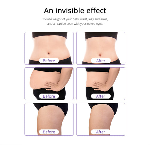 lipo cavitation after liposuction