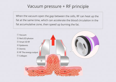 Radio Frequency Treatment